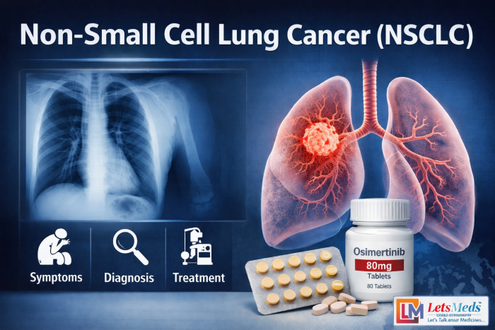 Lung Cancer in the Philippines: Understanding Non-Small Cell Lung Cancer