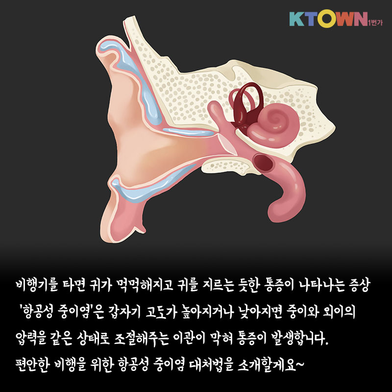비행기 타면 귀가 먹먹하고 아픈  항공성 중이염 대처법